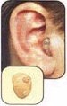 Canal Hearing Aids